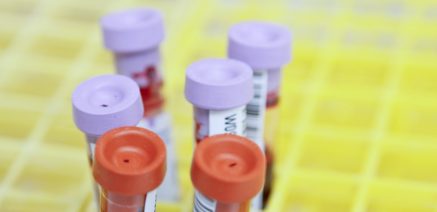 Finger-prick blood sample for HbA1c diabetes test at The Health Dispensary, Neath