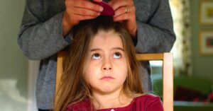 treat head lice